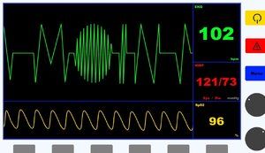 EKG.jpg